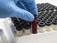تولید اسپرم انسان در آزمایشگاه