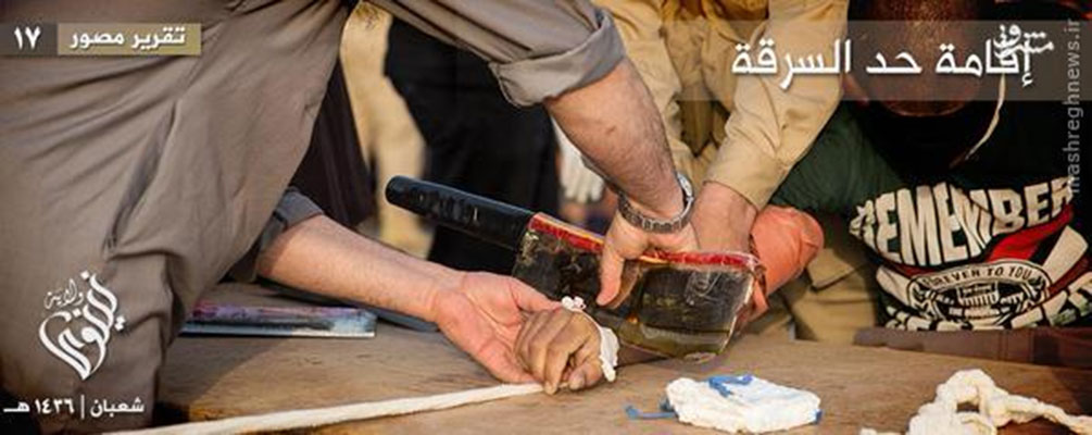داعش، دست یک جوان عراقی را قطع کرد! + تصاویر