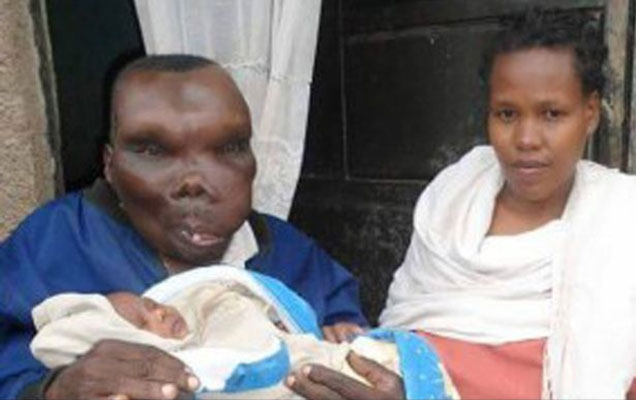 "زشت ترین مرد اوگاندا" مجددا پدر شد + عکس