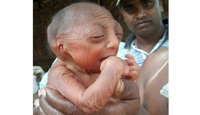 (تصویر) تولد نوزاد 110 ساله عجیب الخلقه!
