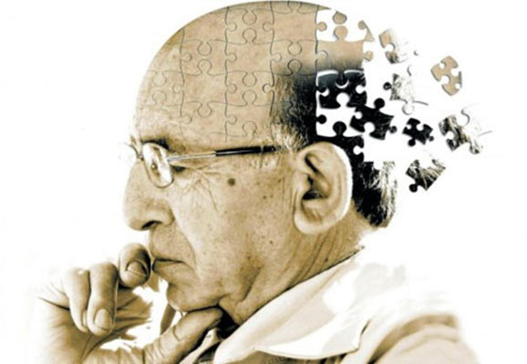 کشف راهکار کاهش ابتلا به آلزایمر