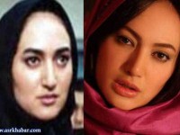 بازیگران زن ایرانی، قبل و بعد از عمل