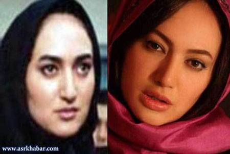 بازیگران زن ایرانی، قبل و بعد از عمل