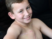 پسر ۱۱ ساله، جوان‌ترین بیماری که عمل پستان‌برداری انجام داد+عکس