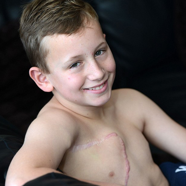 پسر ۱۱ ساله، جوان‌ترین بیماری که عمل پستان‌برداری انجام داد+عکس