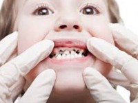 حکایت قطره ای که دندان کودک را سیاه می کند