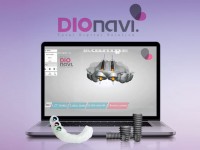 بومی سازی تکنولوژی دندان پزشکی تمام دیجیتال در کشور