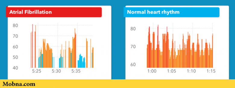ساعت اپل ۹۷ درصد موارد اختلالات قلبی را درست تشخیص می‌دهد!