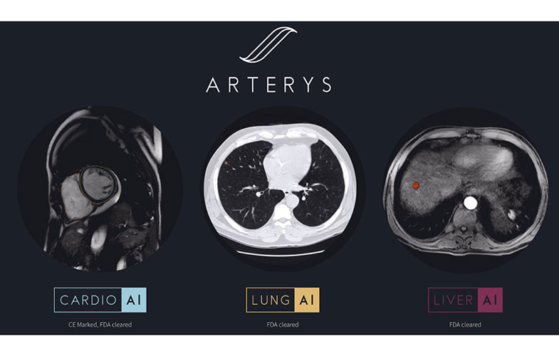Arterys Medical Imaging Lung Liver
