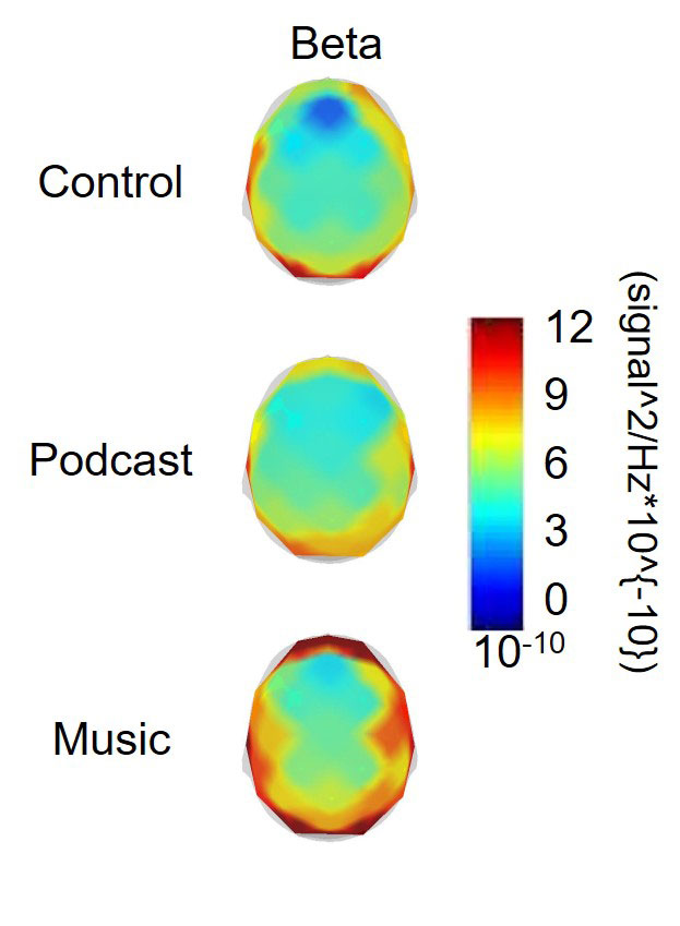 موسیقی فرکانس مغز را تغییر می‌دهد