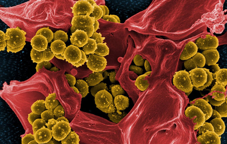 نانورباتی که مواد سمی و باکتری را از خون جدا می‌کند