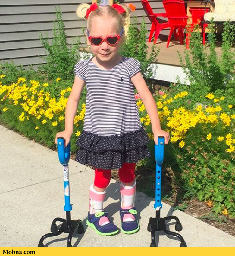 علم پزشکی رویای راه رفتن را برای این دختر ممکن ساخت!(+عکس و فیلم)