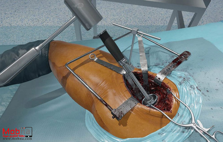 FUNDAMENTAL SURGERY Surgical simulation VR virtual reality haptics SHIE technology blog Blog article 1030x687