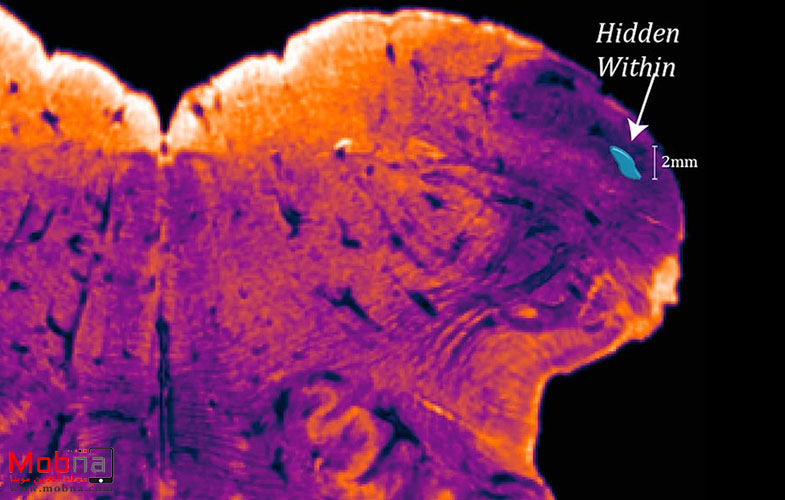قسمت جدیدی در مغز انسان کشف شد (+عکس)