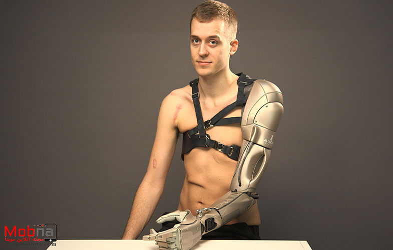 137642 games news watch bodyhack metal gear man and the story of a real life snake bionic arm image7 a1ICGEck9J