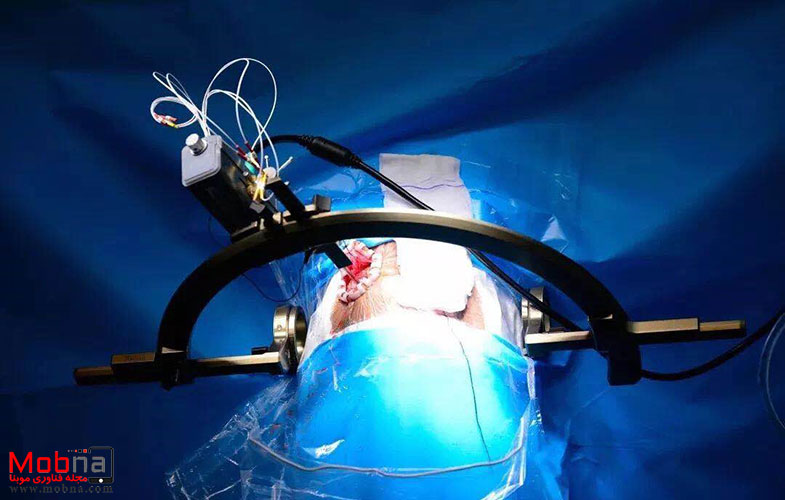نخستین عمل جراحی از راه دور در بستر 5G توسط هواوی در چین (+عکس)