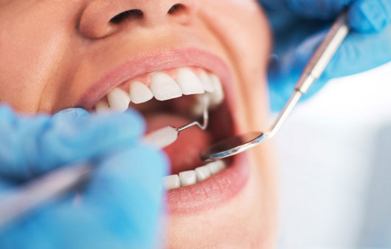 سلامت دهان و دندان با 4 مکمل طبیعی