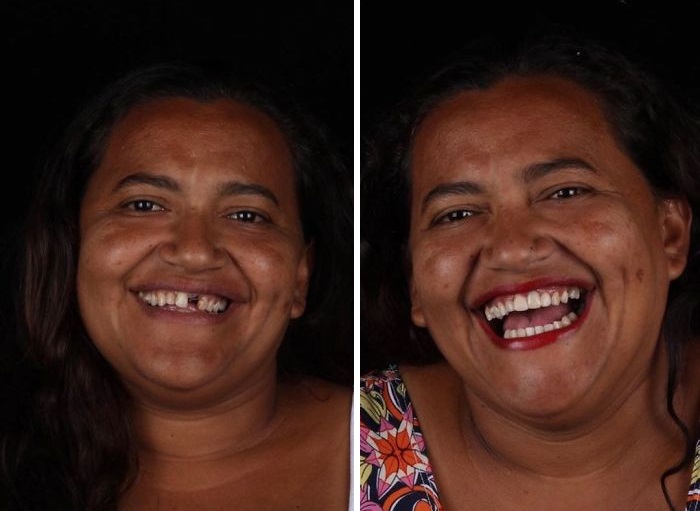 دندانپزشکی که لبخند را به افراد کم بضاعت هدیه می کند! (+عکس)