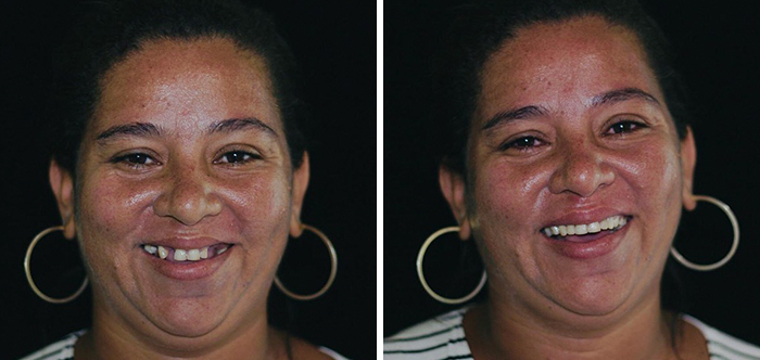 دندانپزشکی که لبخند را به افراد کم بضاعت هدیه می کند! (+عکس)
