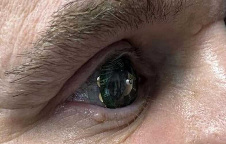 آزمایش نخستین لنز چشمی مجهز به واقعیت افزوده
