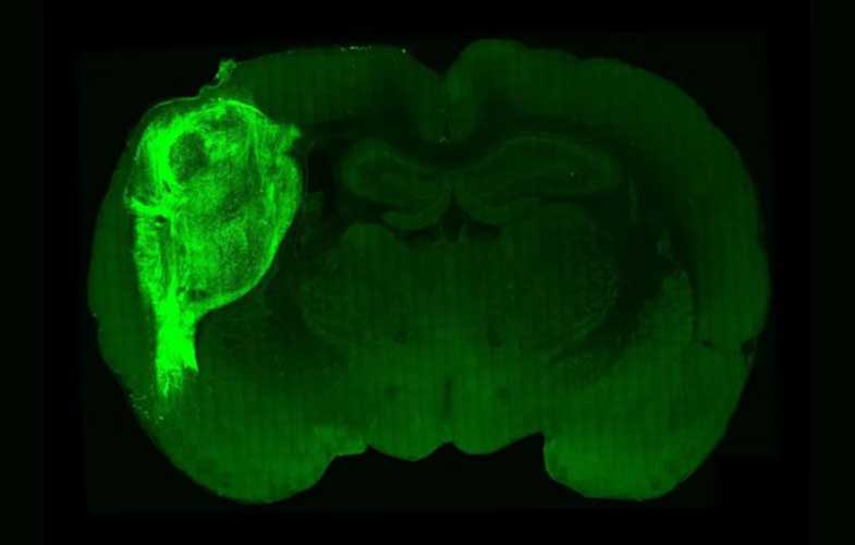 پرورش سلول‌های مغزی انسان در مغز موش