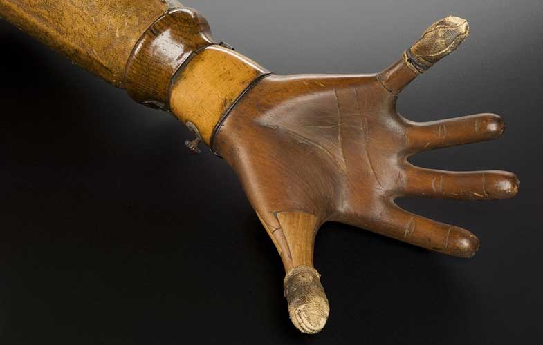 عجیب ترین دست مصنوعی یک زن در موزه علوم لندن! (+عکس)