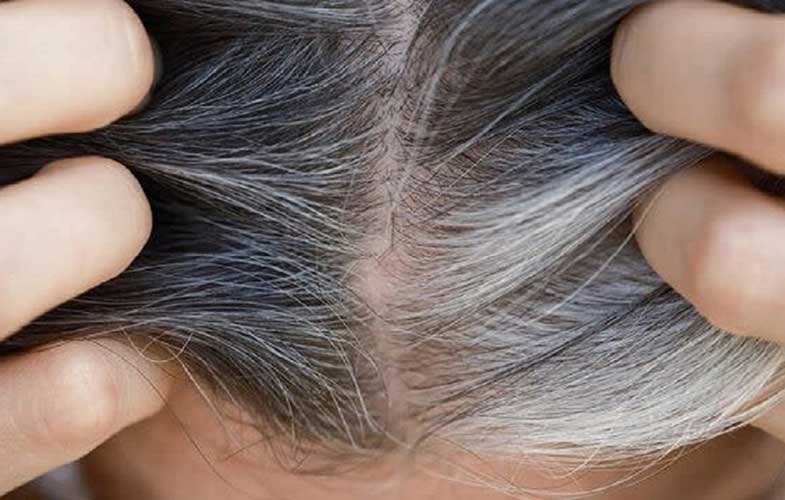 کشف راهی برای جلوگیری از سفید شدن موها