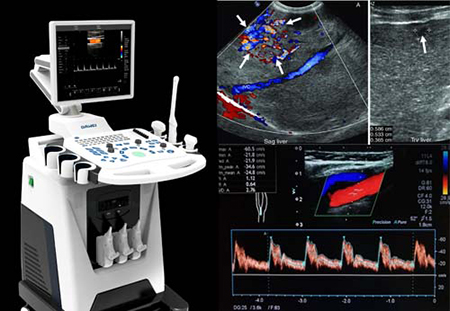 سونوگرافی داپلر رنگی؛ یک ابزار قدرتمند برای تشخیص و درمان