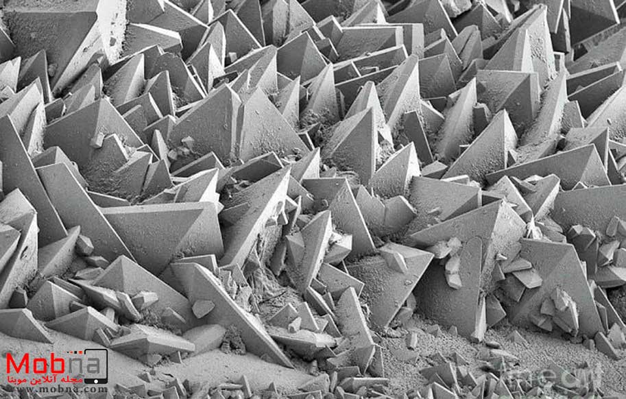 تصویری باورنکردنی از سنگ کلیه زیر میکروسکوپ الکترونی!