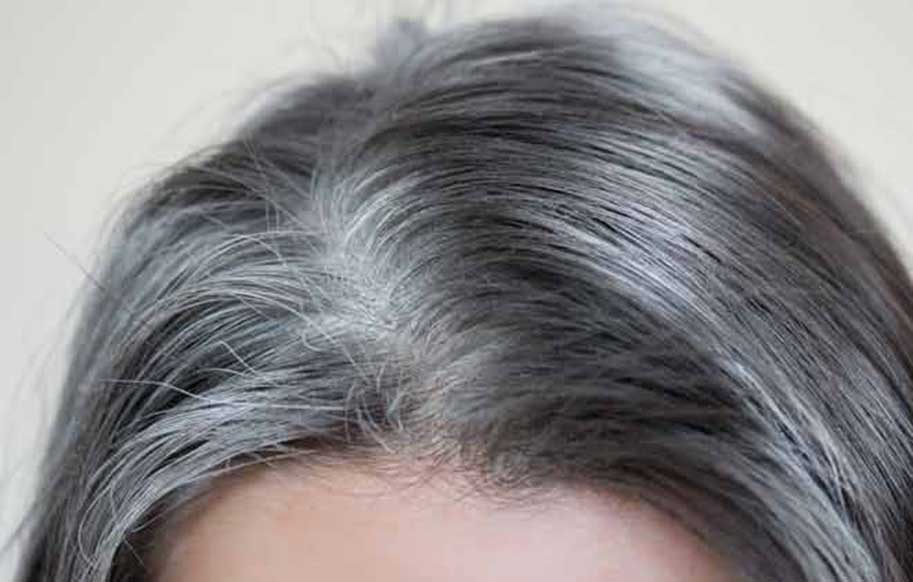 مهمترین دلایل سفید شدن مو و روش‌های رفع آن