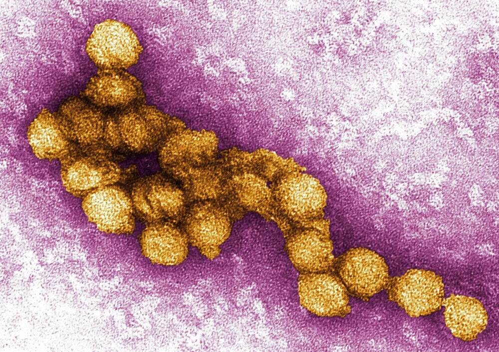ویروس نیل غربی چیست؟ / چگونه مبتلا می شویم، چه علائمی دارد و چگونه درمان می شود؟